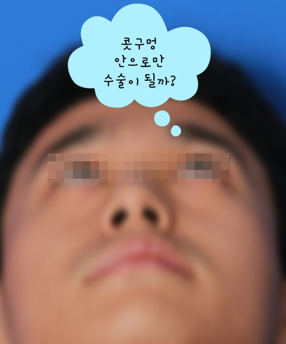 코수술.jpg