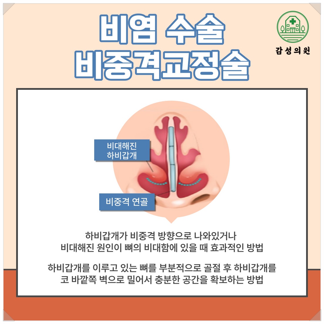 비염4.jpg