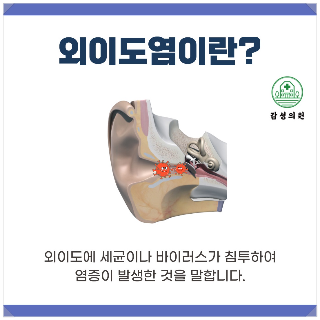 외의도염3.jpg